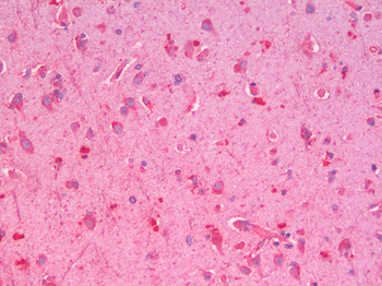 GLP1R/GLP-1 Receptor Antibody