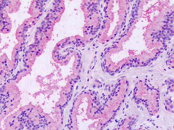 GPRC5A/RAI3 Antibody