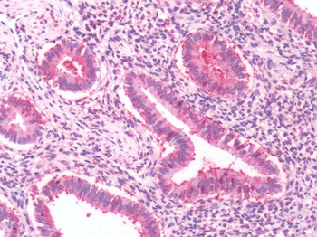GPRC5A/RAI3 Antibody