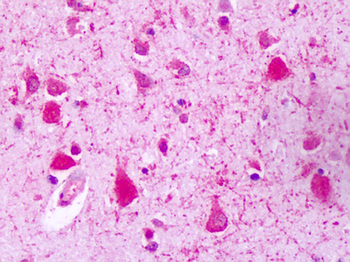 GPRC5A/RAI3 Antibody