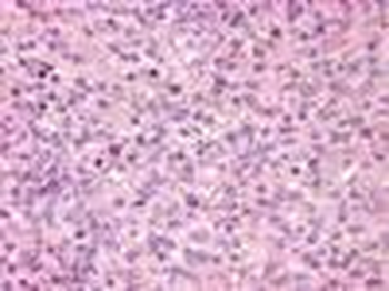 GPR171 Antibody