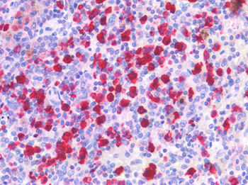 BTLA/CD272 Antibody