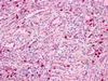 GPR171 Antibody