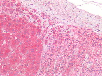 Proenkephalin/PENK Antibody