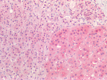 Proenkephalin/PENK Antibody