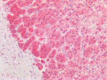 TH/Tyrosine Hydroxylase Antibody
