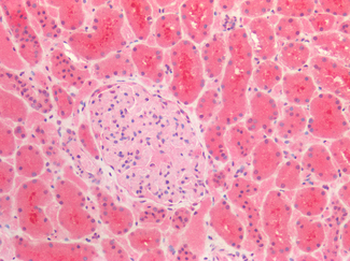 TNC/Tenascin C Antibody