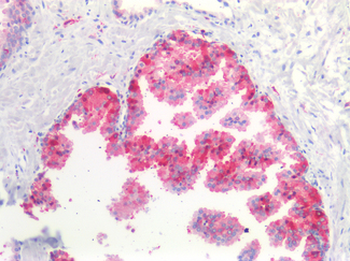 NEFH/NF-H Antibody