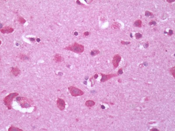 GPR34 Antibody