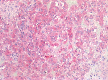 CSPG4/NG2 Antibody