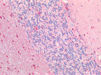 SLC6A3/Dopamine Transporter Antibody