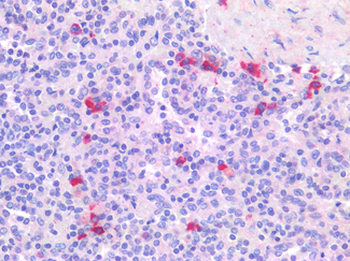 BTLA/CD272 Antibody