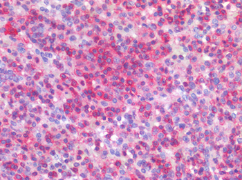CD45/LCA Antibody