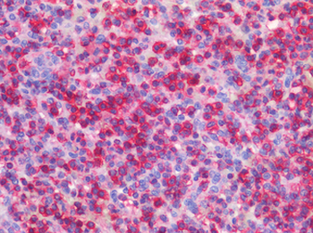 CD45/LCA Antibody