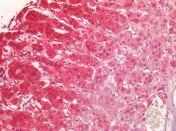 NOTCH2 Antibody