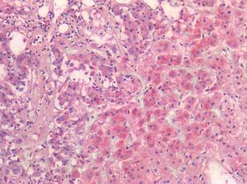 NOTCH2 Antibody