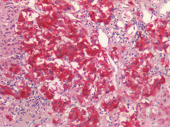 NOTCH2 Antibody