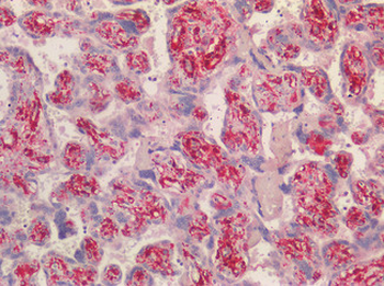 TAGLN/Transgelin/SM22 Antibody