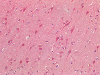 NALP3/NLRP3 Antibody