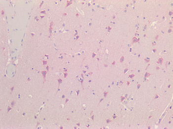NALP3/NLRP3 Antibody