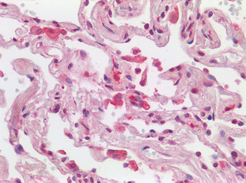 AIF1/IBA1 Antibody
