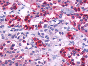 CHRM5/M5 Antibody