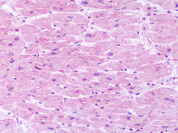 TACR1/NK1R Antibody