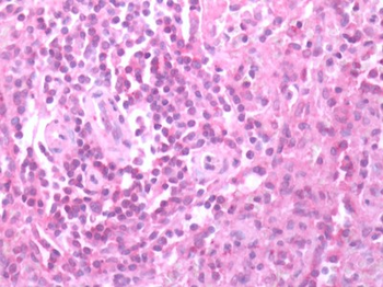 CXCR3 Antibody