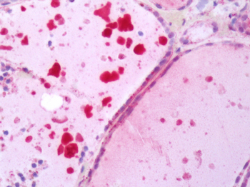TSH Receptor/TSHR Antibody