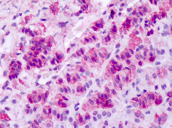 MCHR1 Antibody