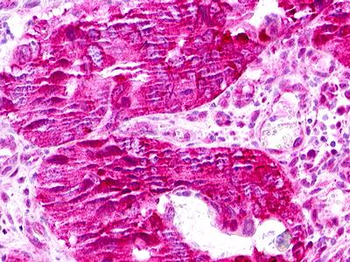 XCR1 Antibody