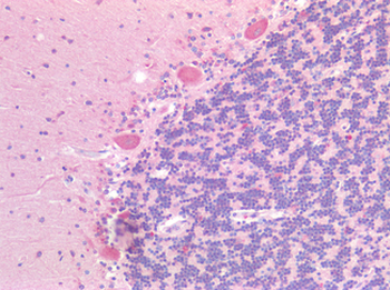 GPR87 Antibody