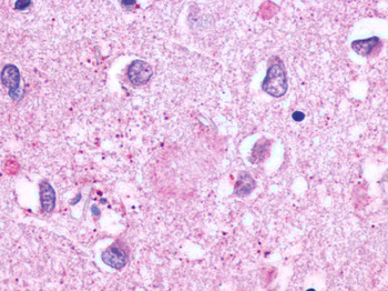 ADGRE3/EMR3 Antibody