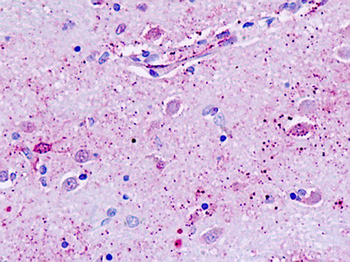 GPR162 Antibody