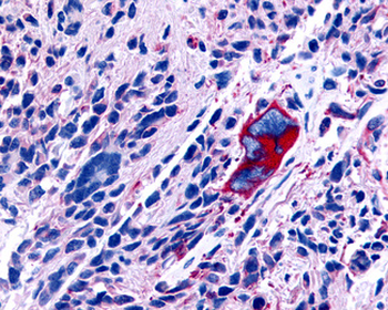 GPR63 Antibody