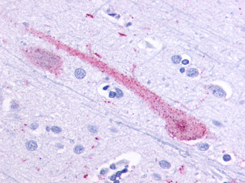 OR51E1 Antibody