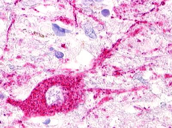 MAS1L/MRG Antibody