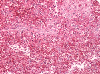 FPR2/FPRL1 Antibody