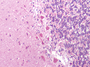 KISS1R/GPR54 Antibody
