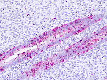 GPBAR1/TGR5 Antibody