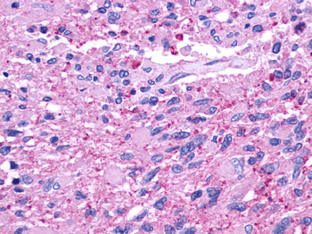CELSR2 Antibody