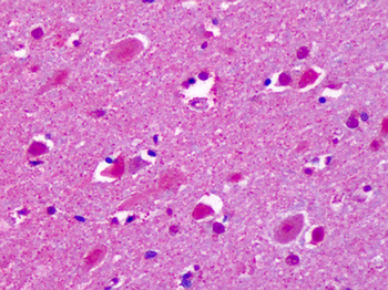 CELSR2 Antibody