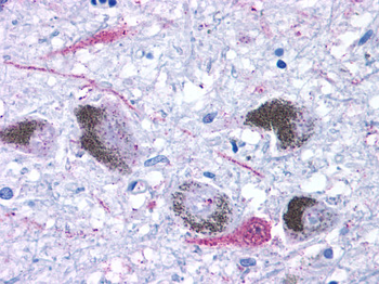 TAAR9 Antibody
