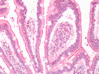 LTB4R2/BLT2 Antibody