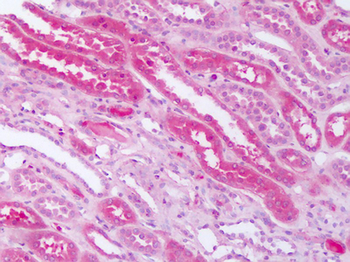 SMO/Smoothened Antibody