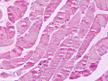 XPR1 Antibody