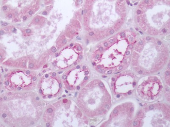 HTR4/5-HT4 Receptor Antibody