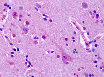GRM7/MGLUR7 Antibody