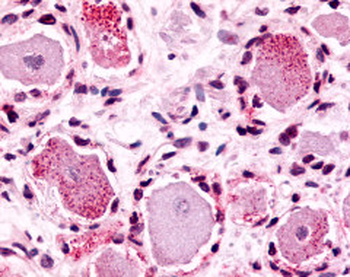 MRGPRX4/MRGX4 Antibody