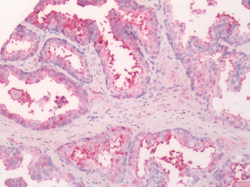 SLC5A3 Antibody